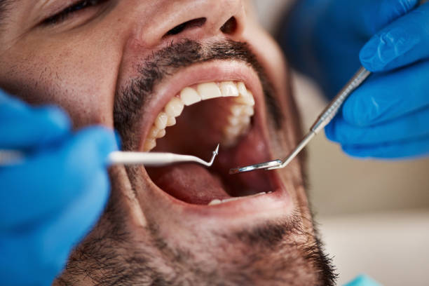 Best Cracked Tooth Emergency Dentist  in Tichigan, WI
