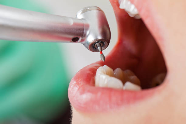 Best Chipped Tooth Repair Near Me  in Tichigan, WI